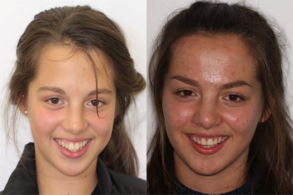 glenview dental treatment